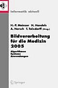 Bildverarbeitung F?r Die Medizin 2005: Algorithmen - Systeme - Anwendungen, Proceedings Des Workshops Vom 13. - 15. M?rz 2005 in Heidelberg