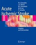 Acute Ischemic Stroke Imaging & Intervention