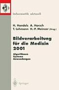 Bildverarbeitung F?r Die Medizin 2001: Algorithmen -- Systeme -- Anwendungen