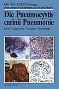 Die Pneumocystis Carinii Pneumonie: Klinik - Diagnostik - Therapie - Prophylaxe