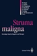 Struma Maligna: Derzeitiger Stand in Diagnose Und Therapie