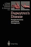 Dupuytren's Disease: Pathobiochemistry and Clinical Management