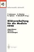Bildverarbeitung F?r Die Medizin 1998: Algorithmen -- Systeme -- Anwendungen Proceedings Des Workshops Am 26. Und 27. M?rz 1998 in Aachen
