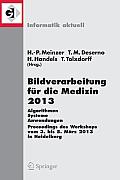 Bildverarbeitung F?r Die Medizin 2013: Algorithmen - Systeme - Anwendungen. Proceedings Des Workshops Vom 3. Bis 5. M?rz 2013 in Heidelberg