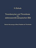Thrombocyten Und Thrombose Im Elektronenmikroskopischen Bild / Electron Microscopy of Blood Platelets and Thrombosis