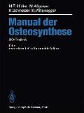 Manual Der Osteosynthese: Ao-Technik