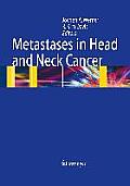 Metastases in Head and Neck Cancer