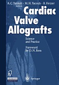 Cardiac Valve Allografts: Science and Practice