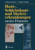 Haut-, Schleimhaut- Und Skeletterkrankungen Skibo-Diseases: Eine Dermatologische-Klinisch-Radiologische Synopse