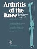 Arthritis of the Knee: Clinical Features and Surgical Management