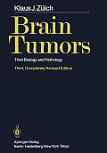 Brain Tumors: Their Biology and Pathology