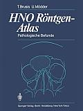 Hno R?ntgen-Atlas: Pathologische Befunde