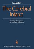 The Cerebral Infarct: Pathology, Pathogenesis, and Computed Tomography