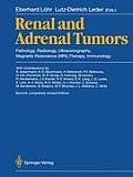 Renal and Adrenal Tumors: Pathology, Radiology, Ultrasonography, Magnetic Resonance (Mri), Therapy, Immunology