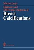 Diagnosis and Differential Diagnosis of Breast Calcifications