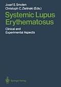 Systemic Lupus Erythematosus: Clinical and Experimental Aspects