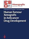 Human Tumour Xenografts in Anticancer Drug Development