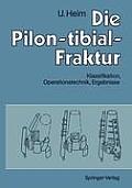 Die Pilon-Tibial-Fraktur: Klassifikation, Operationstechnik, Ergebnisse