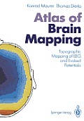 Atlas of Brain Mapping: Topographic Mapping of Eeg and Evoked Potentials