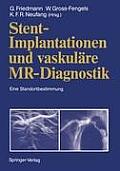 Stent-Implantationen Und Vaskul?re Mr-Diagnostik: Eine Standortbestimmung