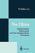 The Elbow: Endoprosthetic Replacement and Non-Endoprosthetic Procedures