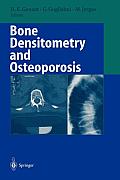 Bone Densitometry and Osteoporosis