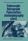 Endoscopic Retrograde Pancreaticocholangiography (Erpc)