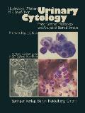 Urinary Cytology: Phase Contrast Microscopy and Analysis of Stained Smears