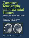 Computed Tomography in Intracranial Tumors: Differential Diagnosis and Clinical Aspects