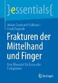 Frakturen Der Mittelhand Und Finger: Eine ?bersicht F?r ?rzte Aller Fachgebiete