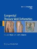Congenital Thoracic Wall Deformities: Diagnosis, Therapy and Current Developments