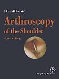 Arthroscopy of the Shoulder: Diagnosis and Therapy