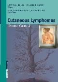 Cutaneous Lymphomas: Unusual Cases 2