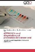 ATP6V1C1 en el diagn?stico y el pron?stico del c?ncer oral