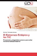 El Embarazo Ectopico y Las Tic