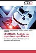 Leucemia: Analisis Por Espectroscopia Raman