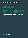 Atlas of Brain Tumors: Light- And Electron-Microscopic Features