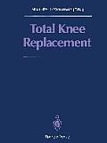 Total Knee Replacement: Proceeding of the International Symposium on Total Knee Replacement, May 19-20, 1987, Nagoya, Japan
