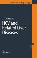 Hcv and Related Liver Diseases