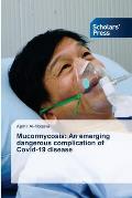 Mucormycosis: An emerging dangerous complication of Covid-19 disease