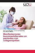 Manifestaciones bucomaxilofaciales en pacientes con colagenopat?as