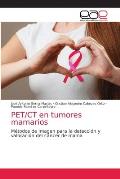 PET/CT en tumores mamarios