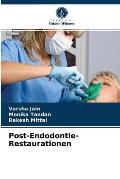 Post-Endodontie-Restaurationen