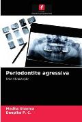 Periodontite agressiva