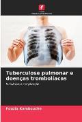 Tuberculose pulmonar e doen?as trombol?acas