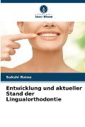 Entwicklung und aktueller Stand der Lingualorthodontie