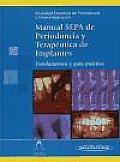 Manual SEPA de periodoncia y terapéutica de implantes / SEPA Manual of periodontics and implant therapy