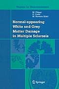 Normal-Appearing White and Grey Matter Damage in Multiple Sclerosis