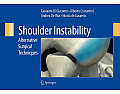 Shoulder Instability: Alternative Surgical Techniques