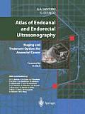 Atlas of Endoanal and Endorectal Ultrasonography: Staging and Treatment Options for Anorectal Cancer